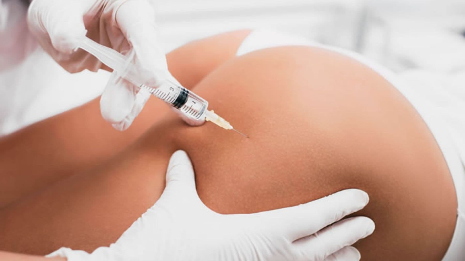 Harmonização de Glúteo